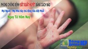Phòng Tránh Bệnh Sốt Xuất Huyết Bằng Cách Nào 300x169 1